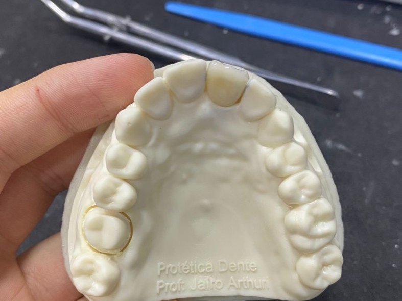 Modelo 3D impresso Protética Dente na bancada técnica com instrumentos de acabamento