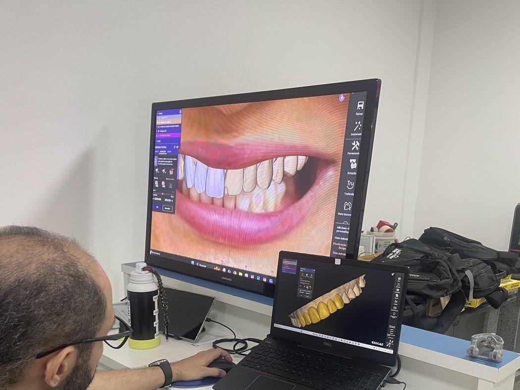 Estação de planejamento digital com software Exocad e desenho do sorriso na tela